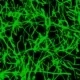 vernetzteglioblastomzellen ukhd klein